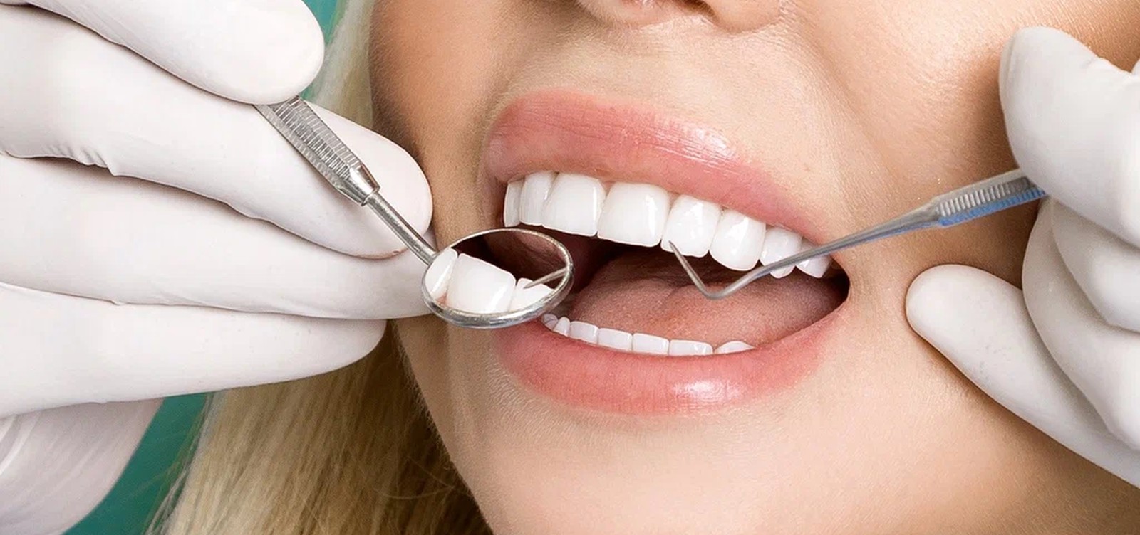 Zirconia - Dentist Muhammet Akturk