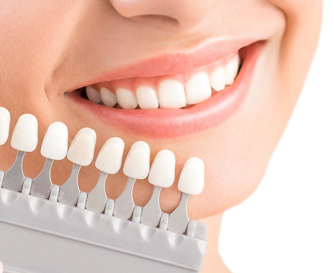 Porselen Diş - Diş Hekimi Muhammet Aktürk - Trabzon - Türkiye