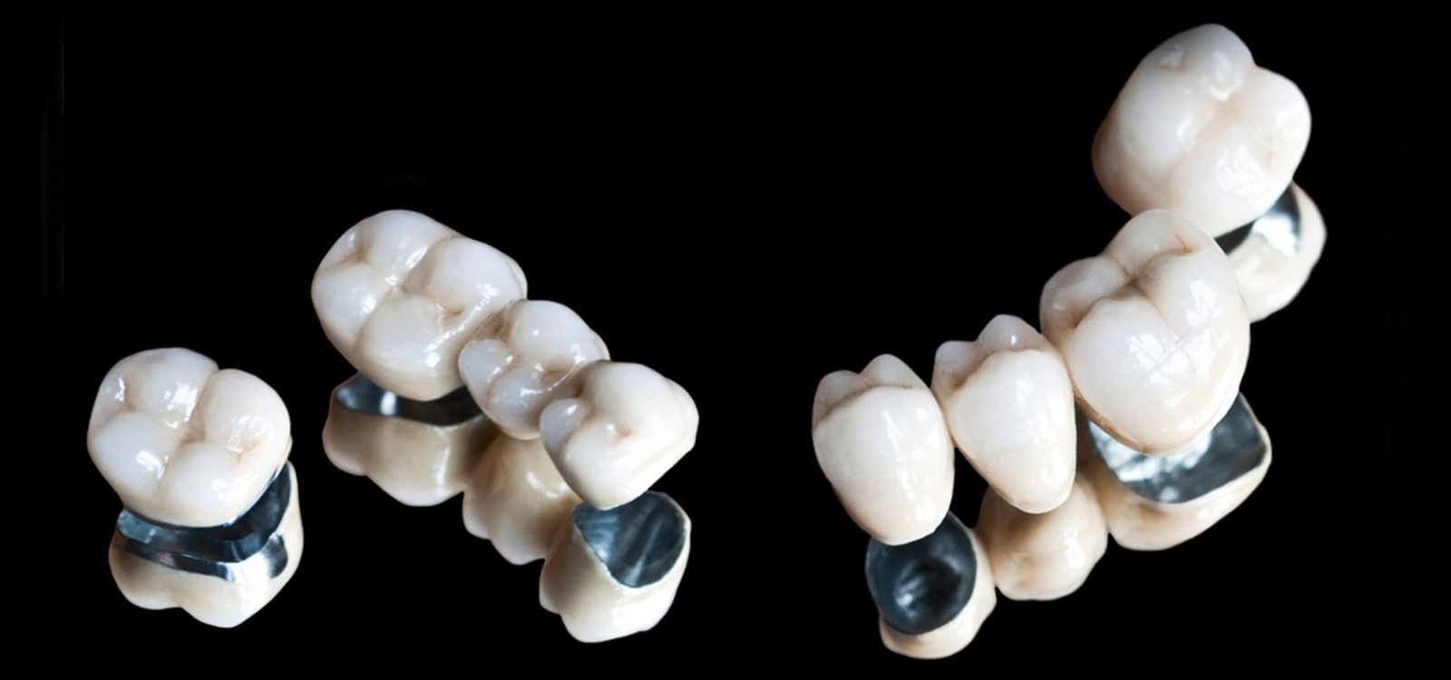 Porcelain Bridge & Crown - Muhammet Akturk - Dentist - Trabzon - Turkey