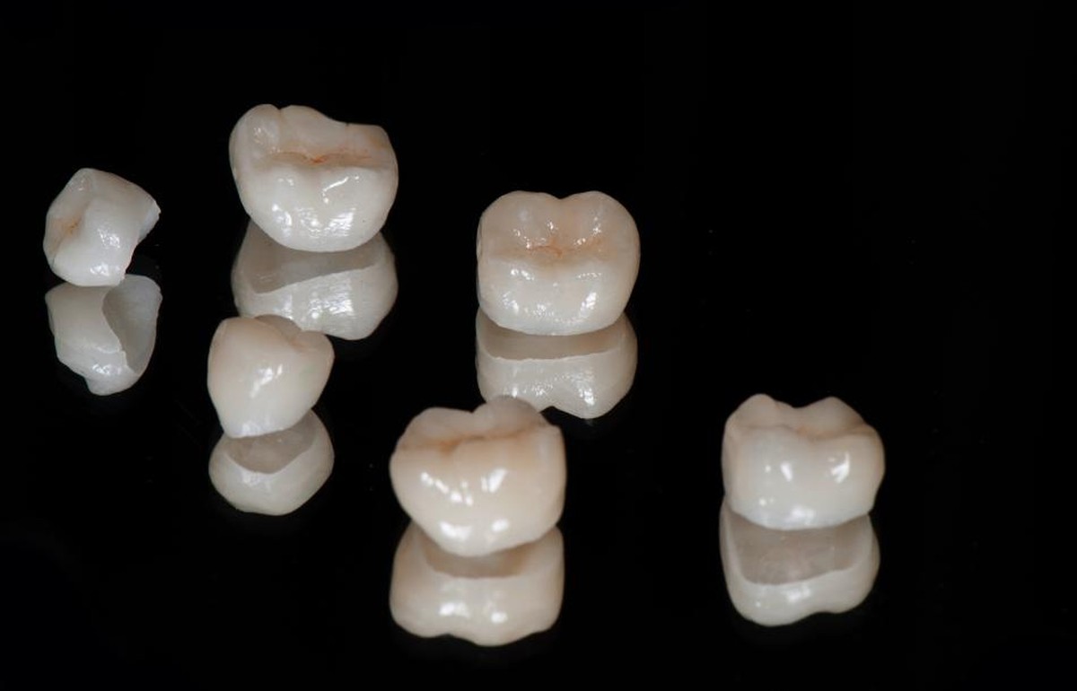 تيجان وجسور الأسنان - طبيب أسنان محمد أكتورك - طرابزون - تركيا