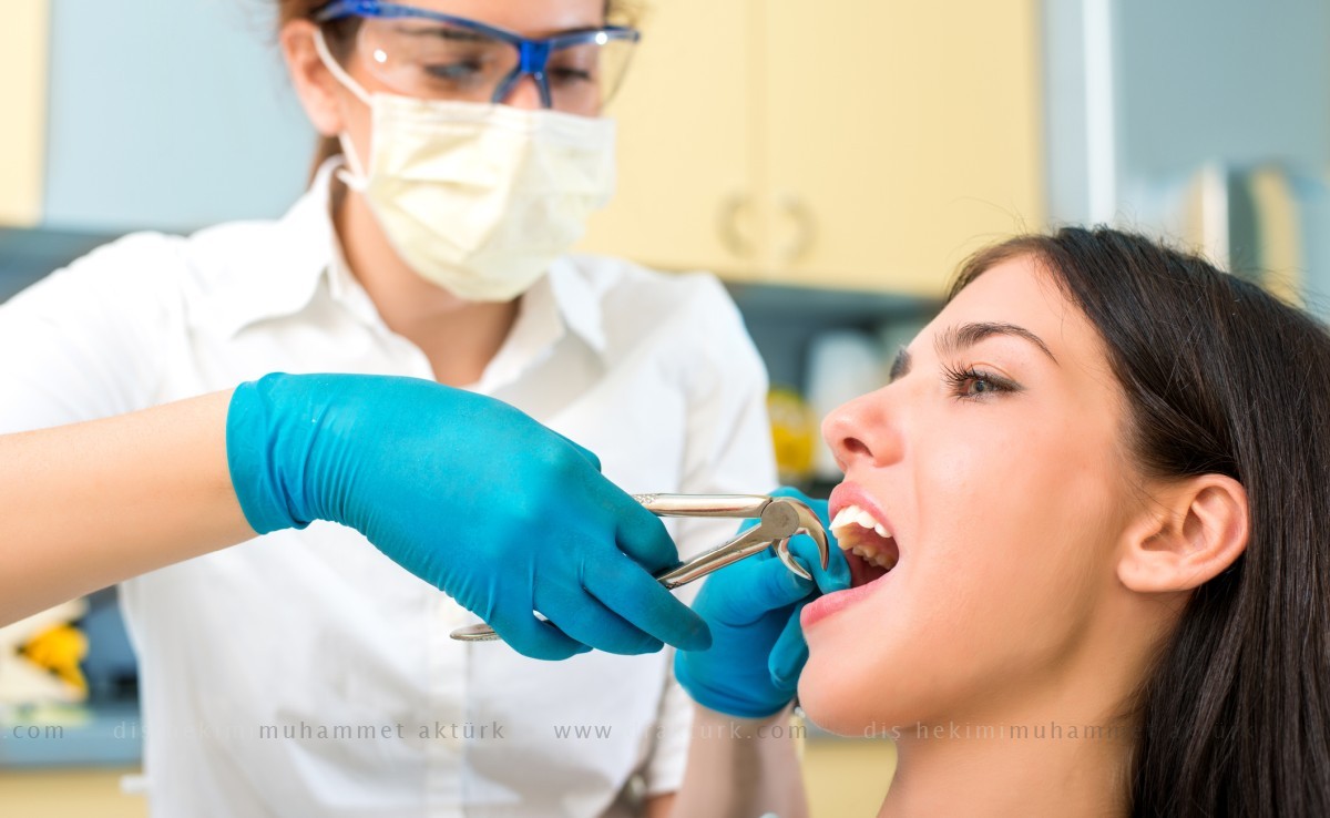 Tooth Extraction - Muhammet Akturk - Dentist - Trabzon - Turkey
