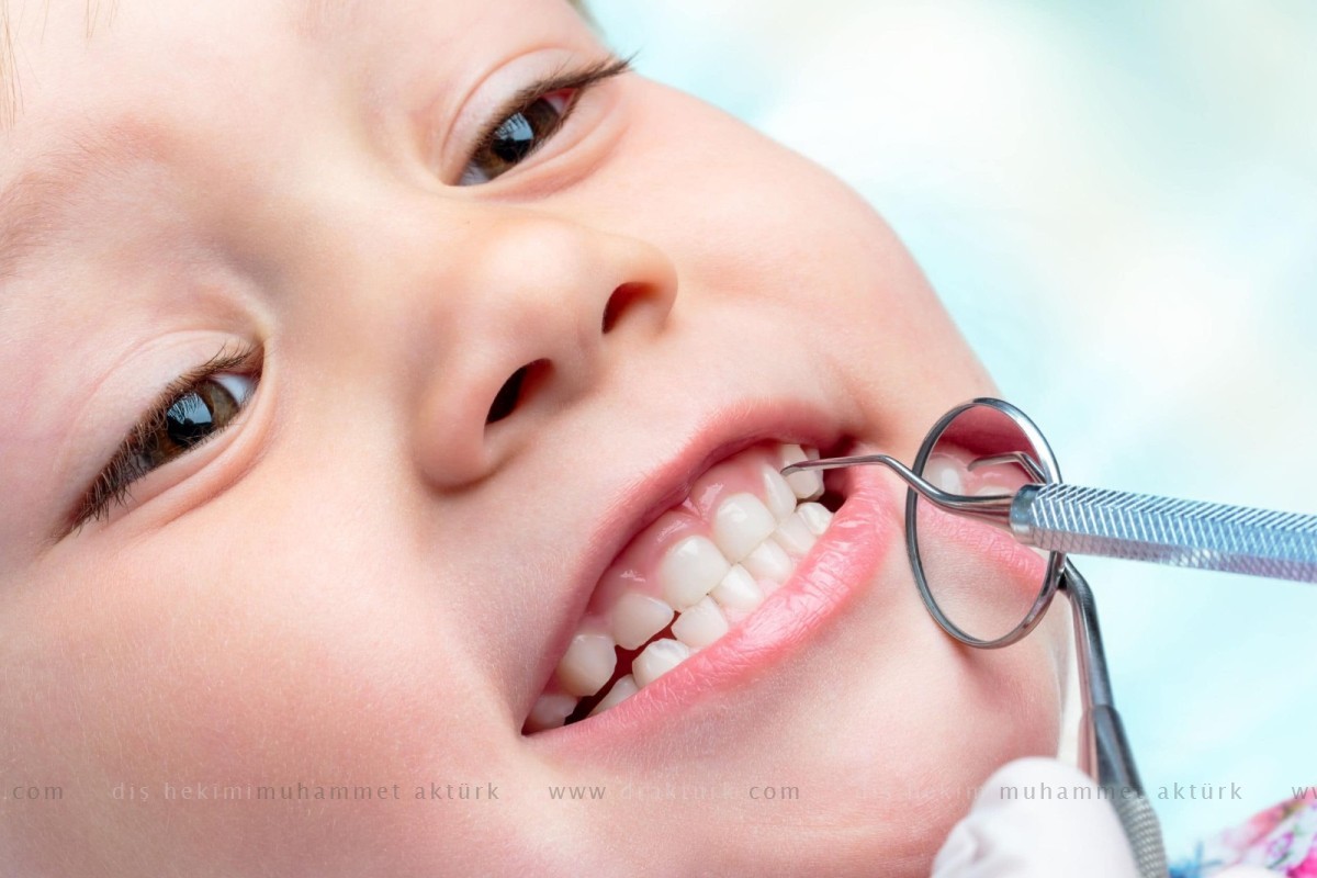  Pediatric Dentistry - Pedodontics - Muhammet Akturk - Dentist - Trabzon - Turkey