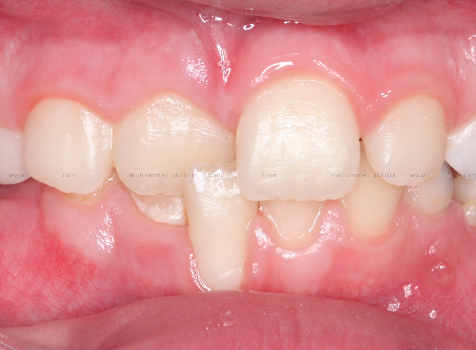 Muhammet Akturk - Dentist - Trabzon - Turkey