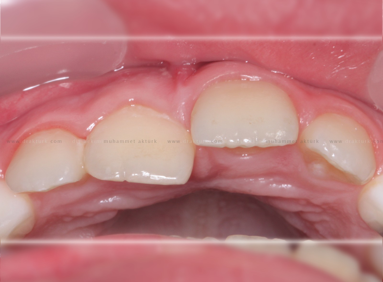 Muhammet Akturk - Dentist - Trabzon - Turkey