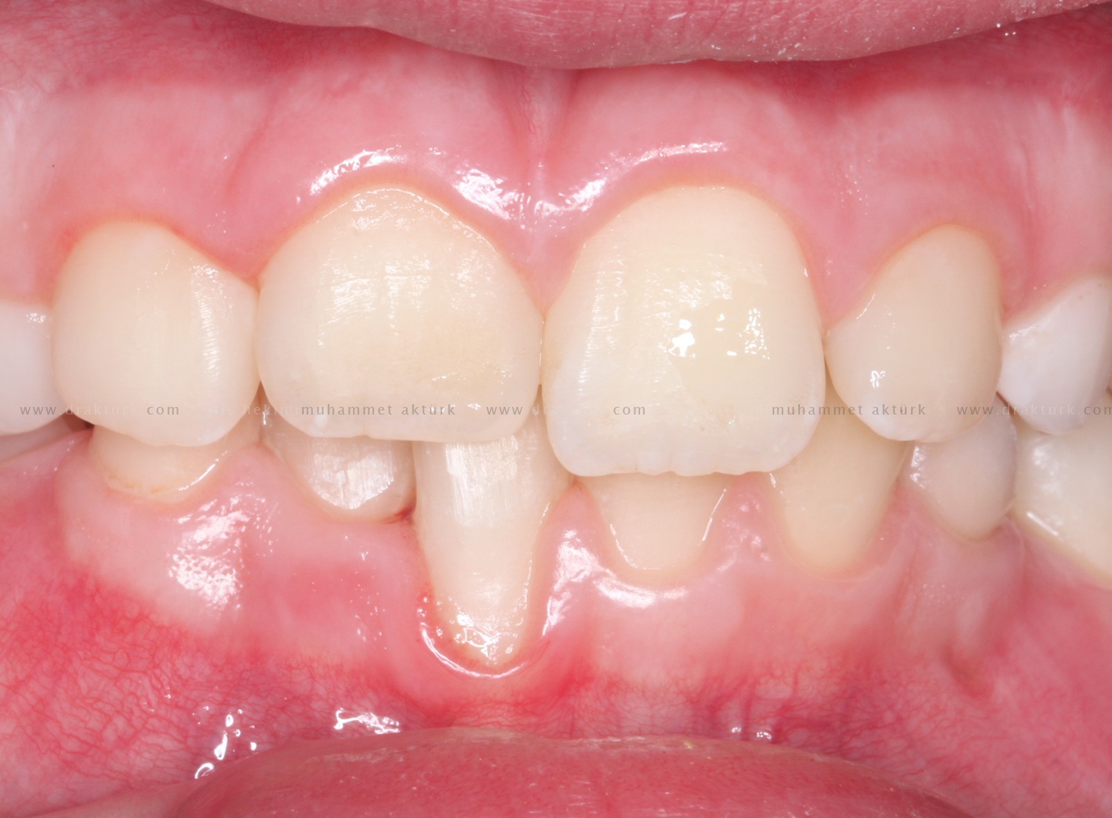 Muhammet Akturk - Dentist - Trabzon - Turkey