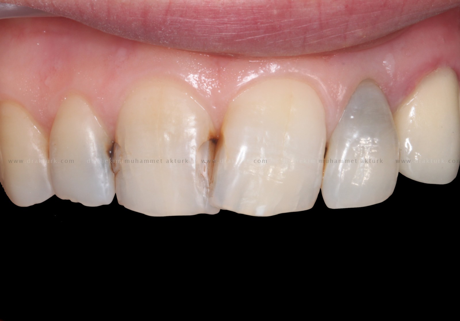 Muhammet Akturk - Dentist - Trabzon - Turkey