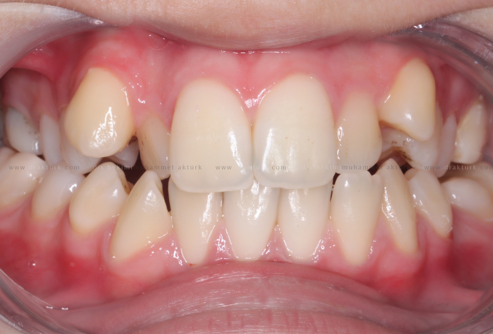 Muhammet Akturk - Dentist - Trabzon - Turkey