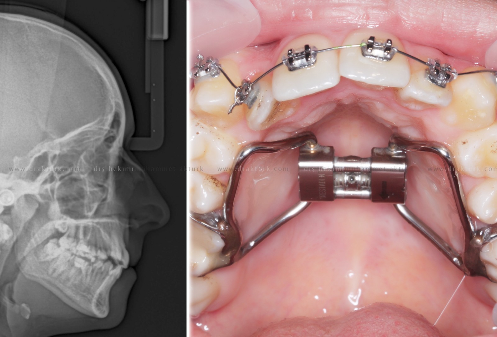 Muhammet Akturk - Dentist - Trabzon - Turkey