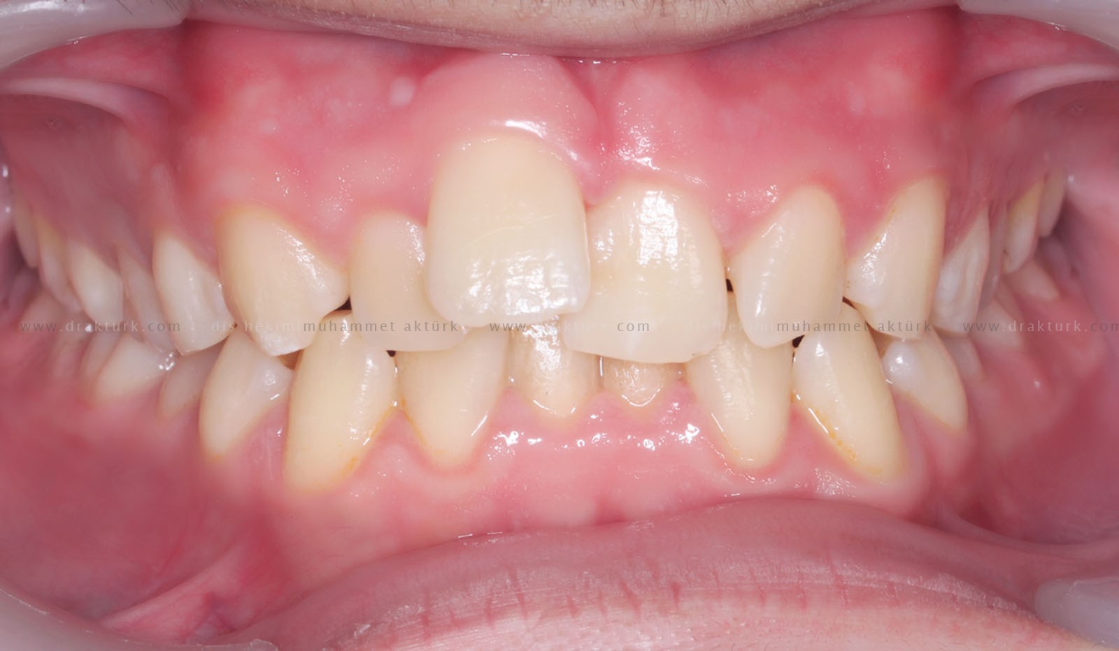 Muhammet Akturk - Dentist - Trabzon - Turkey