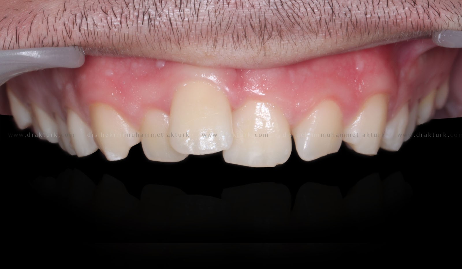 Muhammet Akturk - Dentist - Trabzon - Turkey