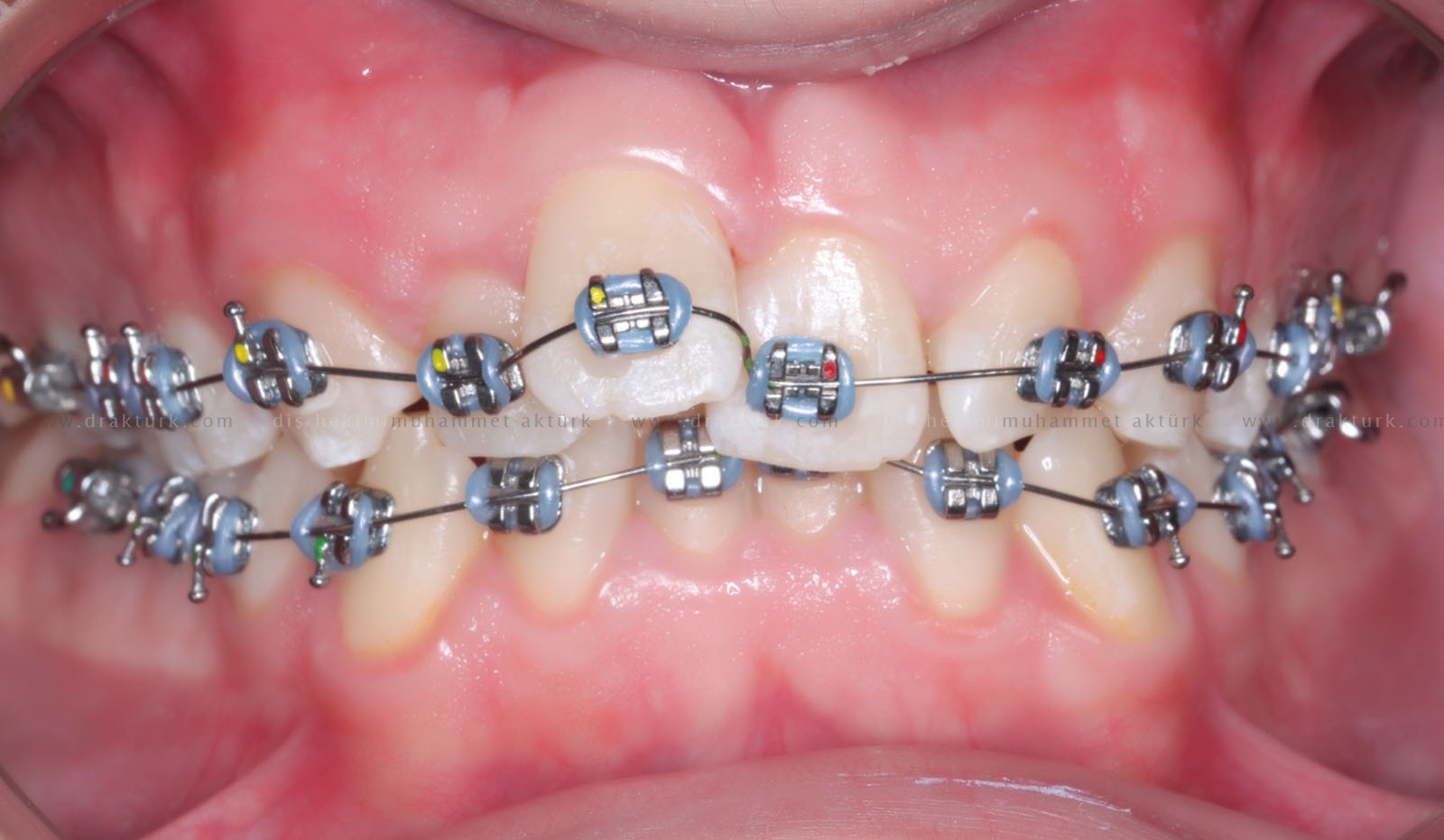 Muhammet Akturk - Dentist - Trabzon - Turkey