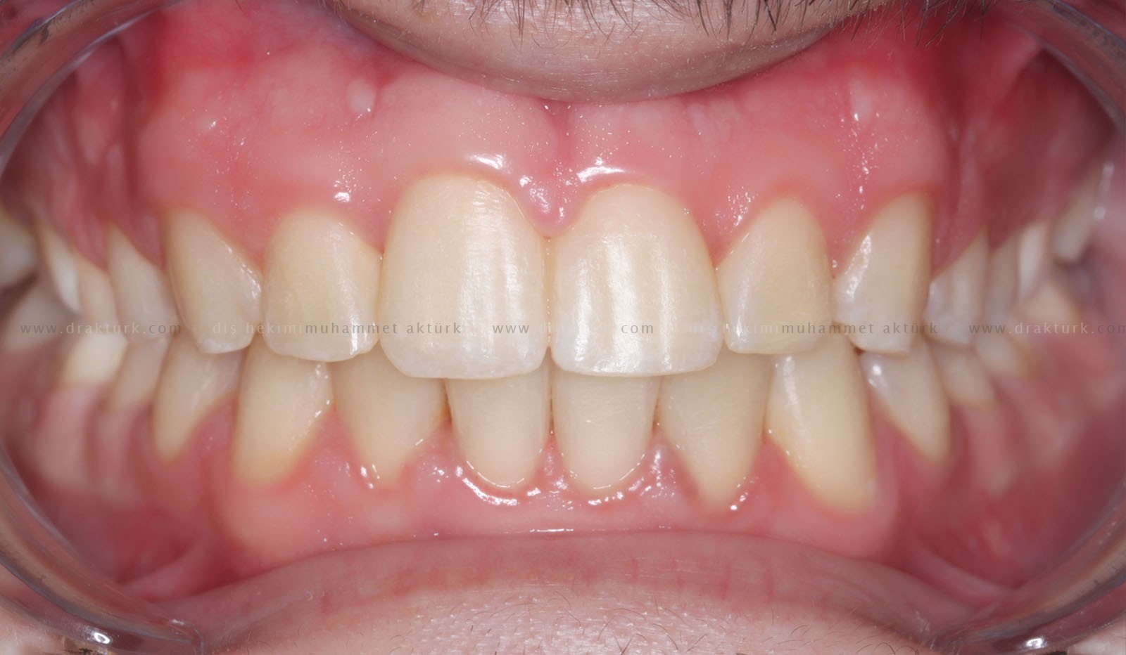 Muhammet Akturk - Dentist - Trabzon - Turkey