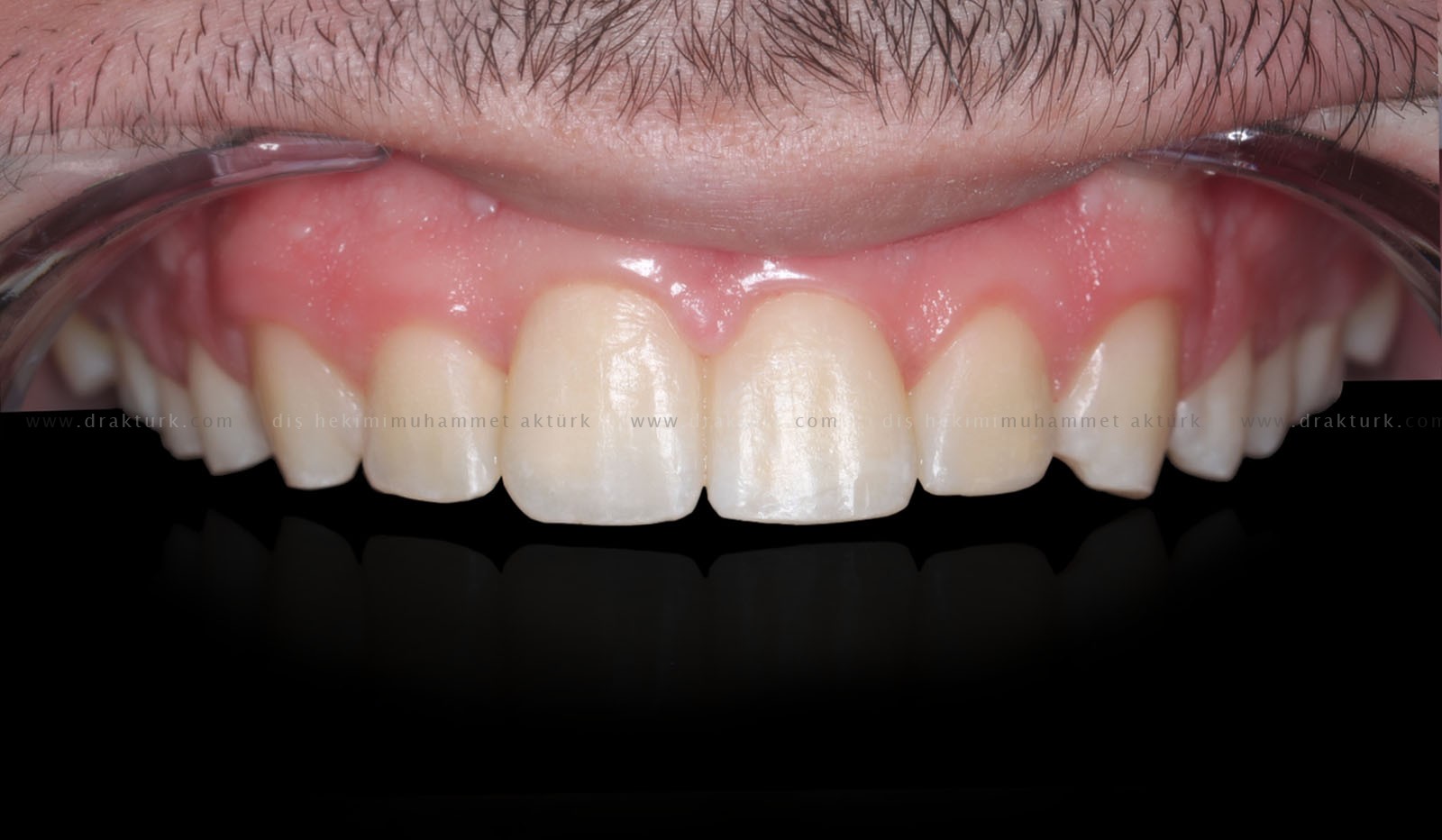 Muhammet Akturk - Dentist - Trabzon - Turkey