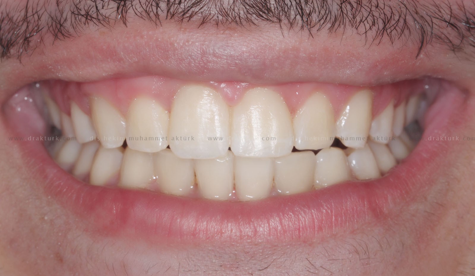 Muhammet Akturk - Dentist - Trabzon - Turkey
