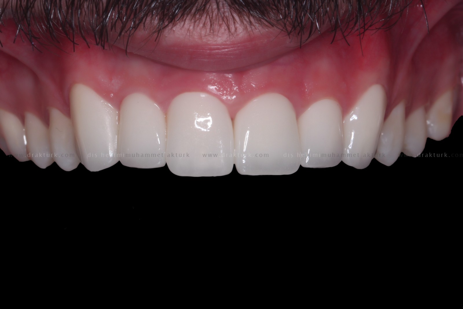 Diş Hekimi Muhammet Aktürk - Trabzon - Türkiye