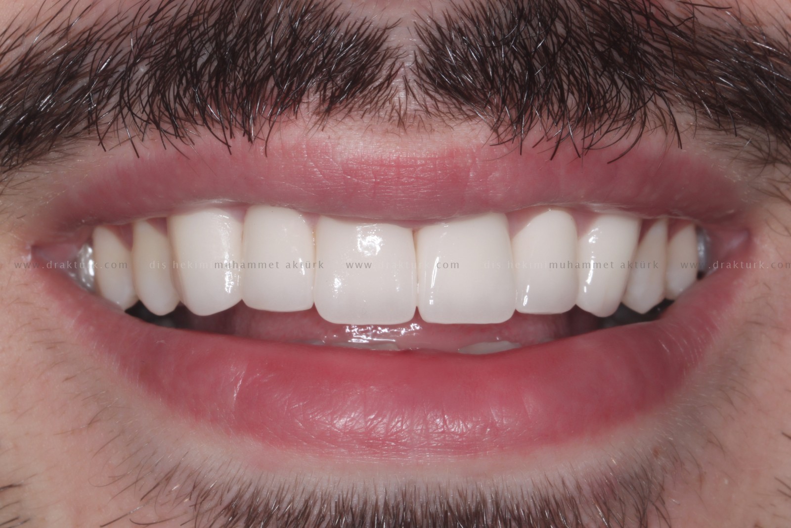 Diş Hekimi Muhammet Aktürk - Trabzon - Türkiye