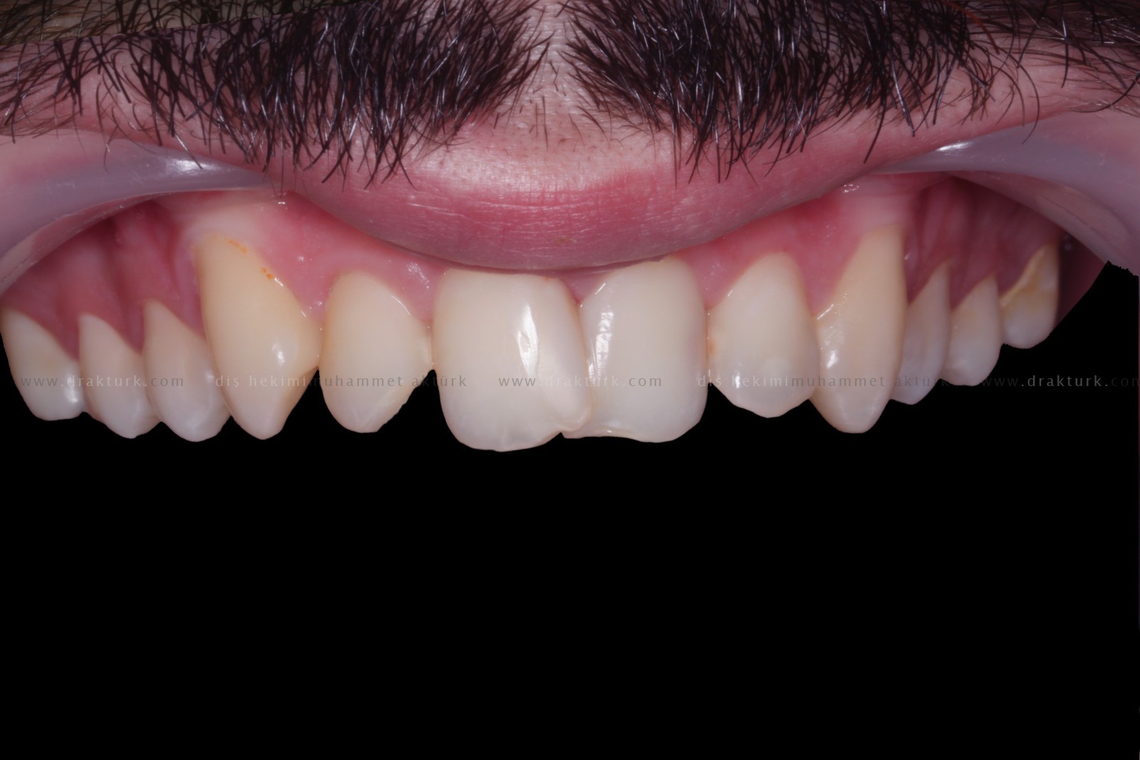 Diş Hekimi Muhammet Aktürk - Trabzon - Türkiye