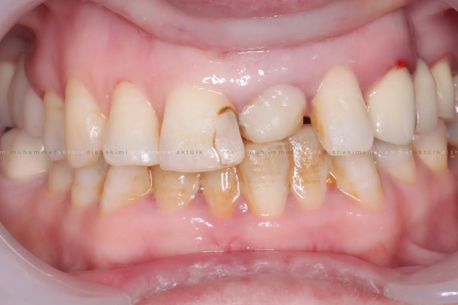 Muhammet Akturk - Dentist - Trabzon - Turkey