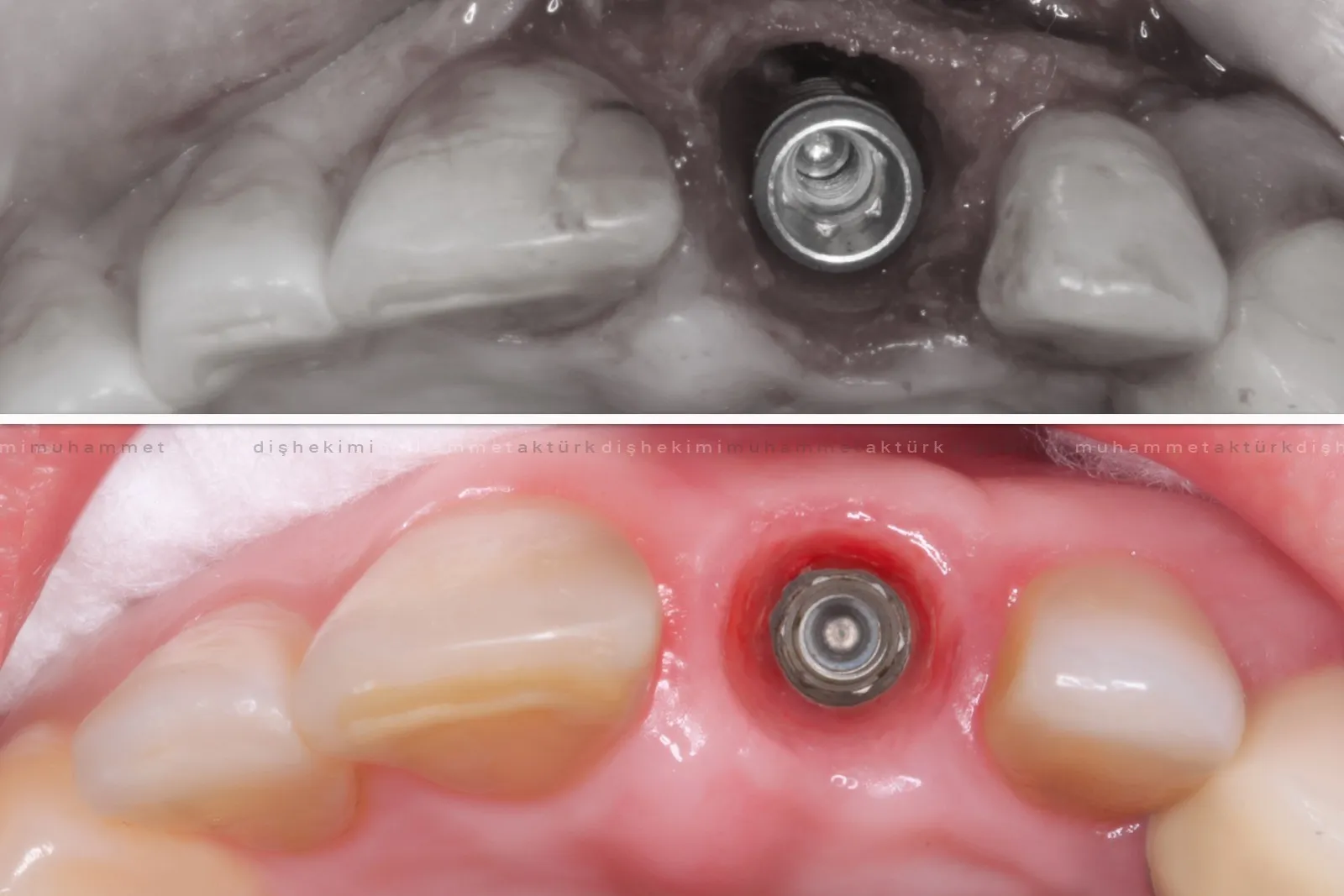 Muhammet Akturk - Dentist - Trabzon - Turkey