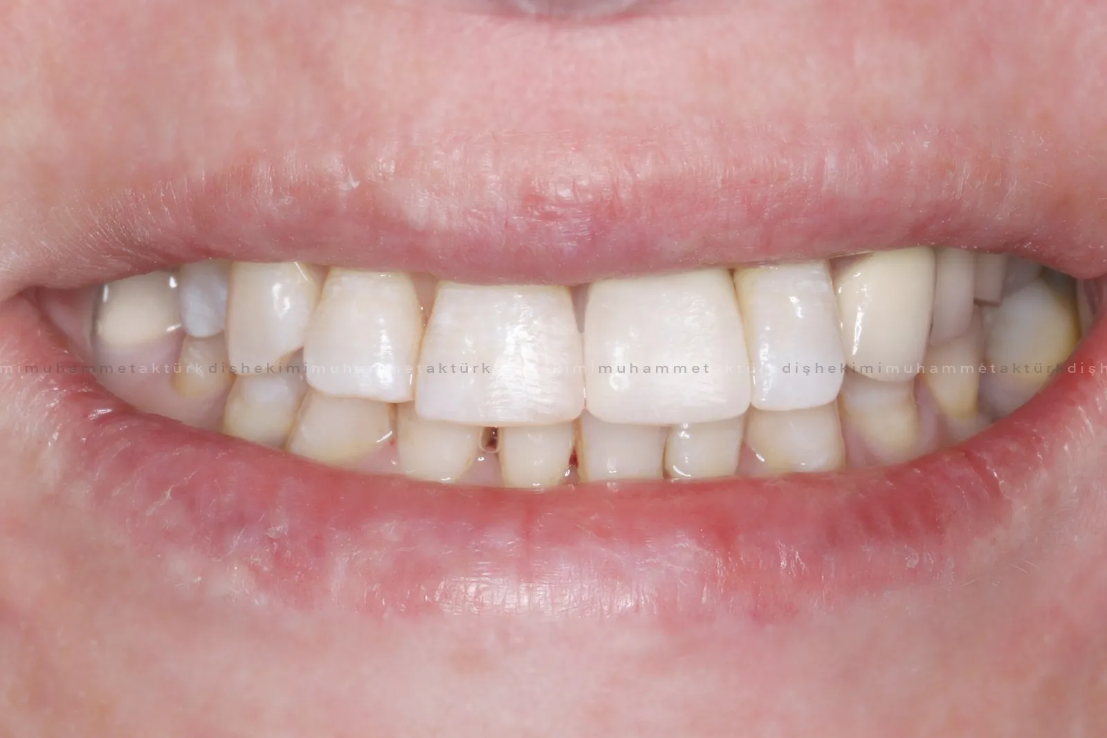 Muhammet Akturk - Dentist - Trabzon - Turkey