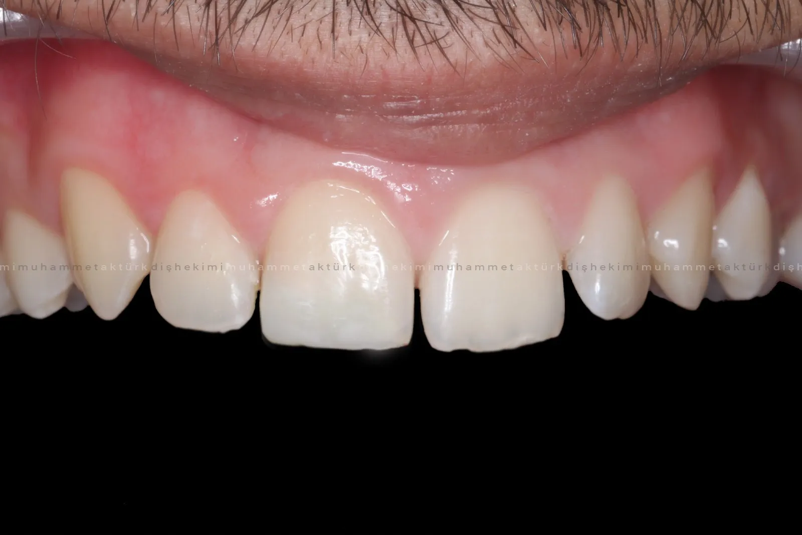 Muhammet Akturk - Dentist - Trabzon - Turkey