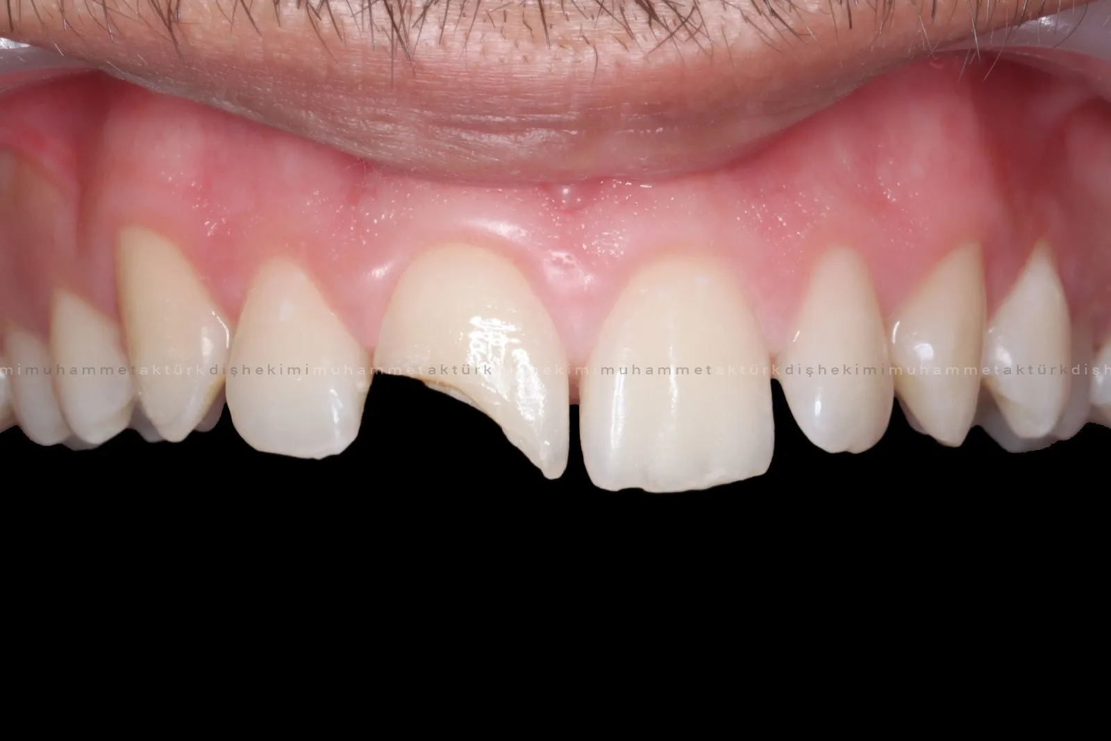 Muhammet Akturk - Dentist - Trabzon - Turkey