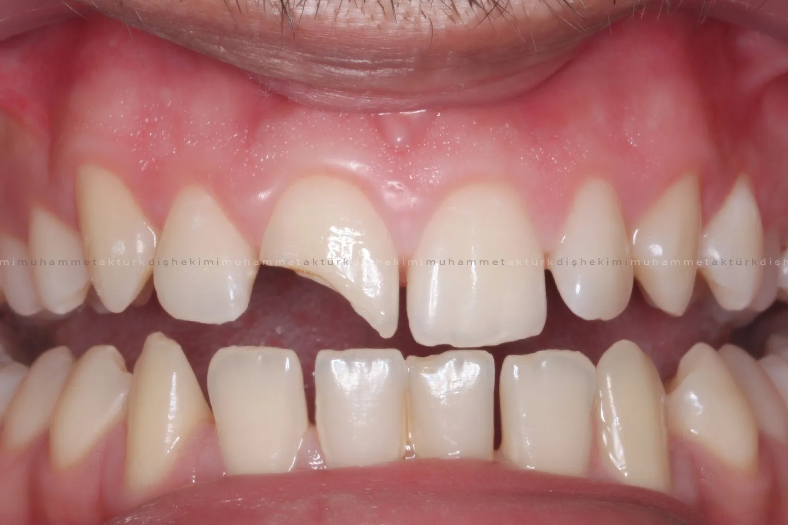 Muhammet Akturk - Dentist - Trabzon - Turkey