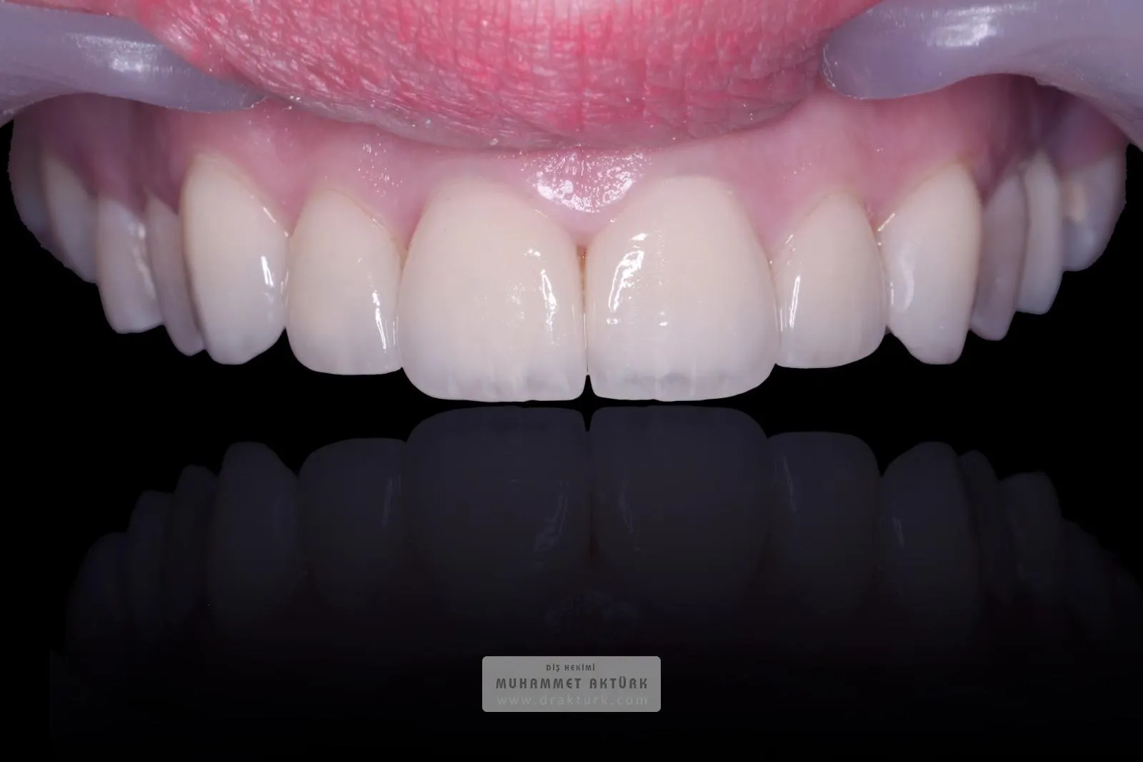 Muhammet Akturk - Dentist - Trabzon - Turkey