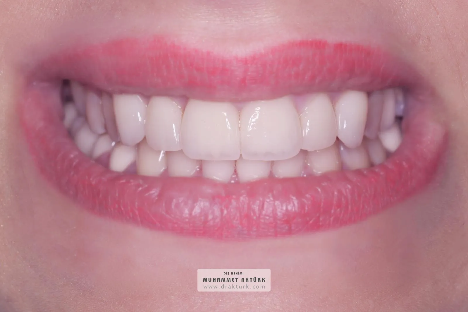 Muhammet Akturk - Dentist - Trabzon - Turkey