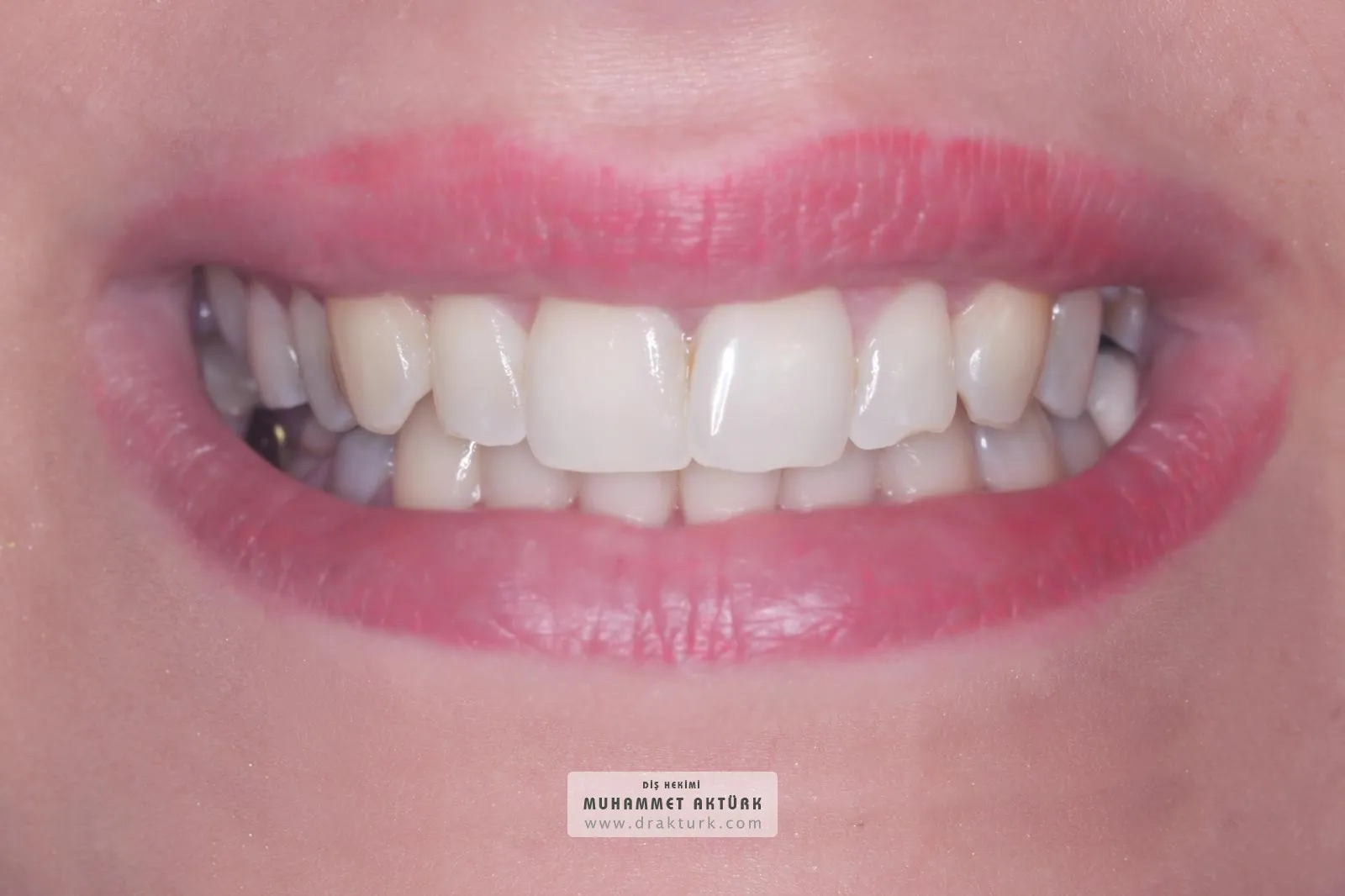 Muhammet Akturk - Dentist - Trabzon - Turkey