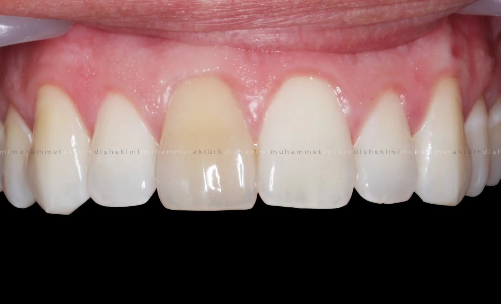 Muhammet Akturk - Dentist - Trabzon - Turkey