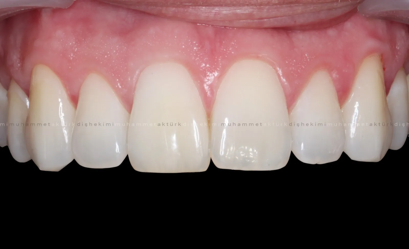 Muhammet Akturk - Dentist - Trabzon - Turkey