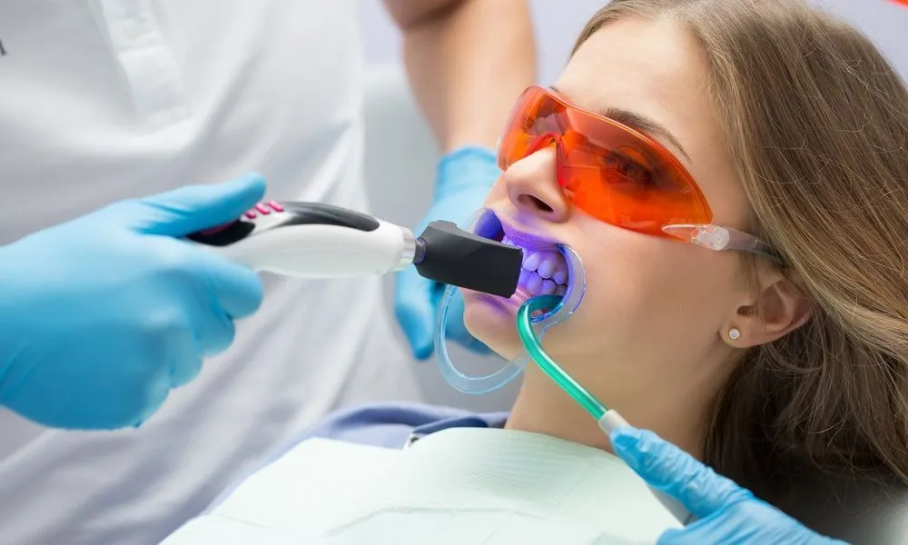 Teeth Whitening - Dentist Muhammet Akturk - Trabzon - Turkey