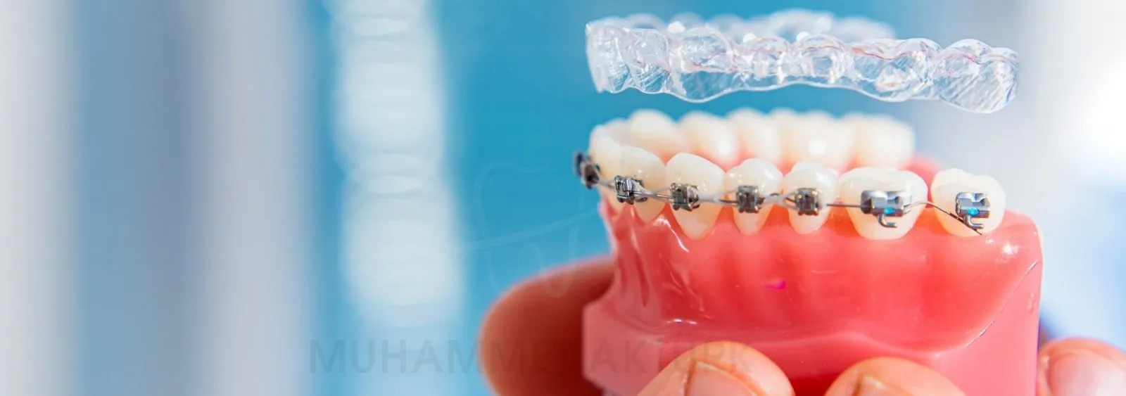 Ortodonti - Diş Hekimi Muhammet Aktürk - Trabzon - Türkiye