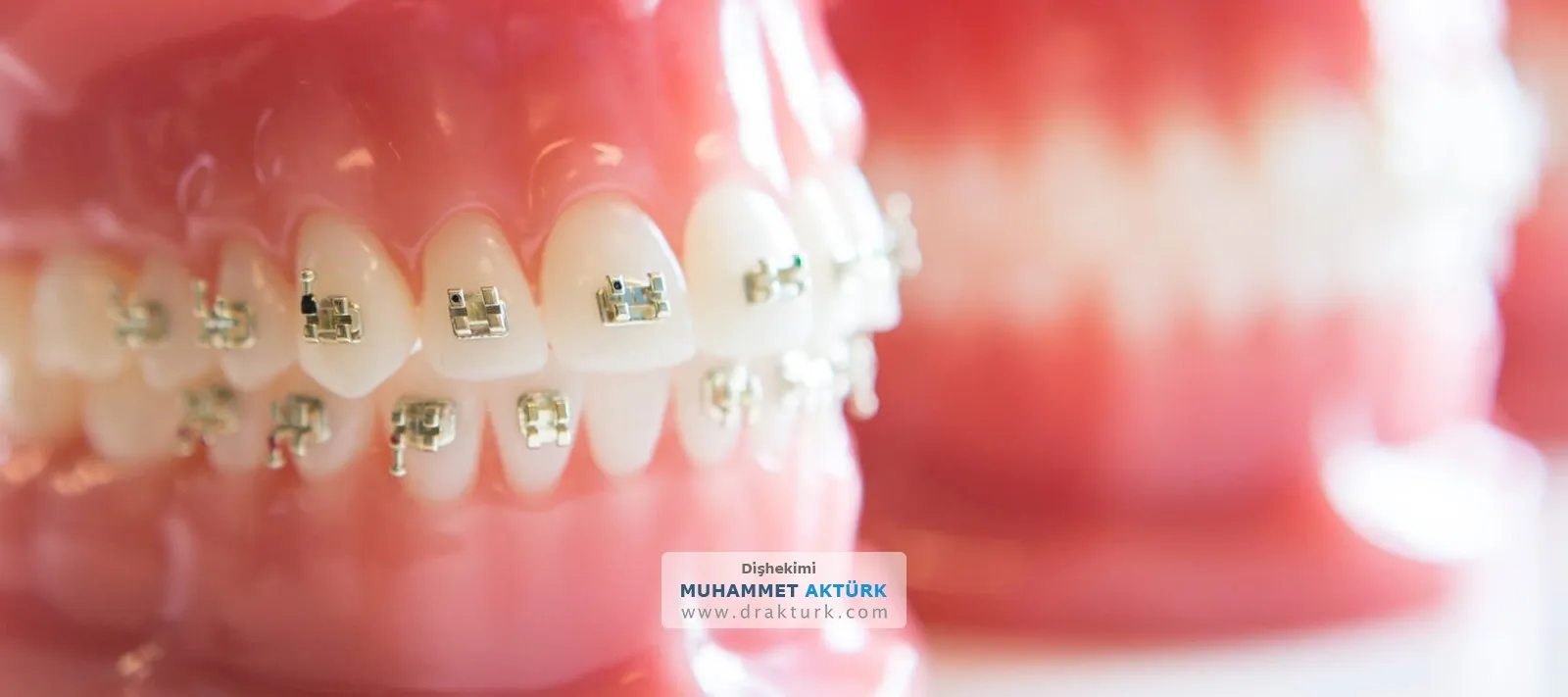 Ortodonti - Diş Hekimi Muhammet Aktürk - Trabzon - Türkiye
