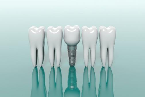 Dental İmplant  Cerrahisi Sonrası Uyulması Gereken Kurallar | Diş Hekimi Muhammet Aktürk | 0462 277 7777